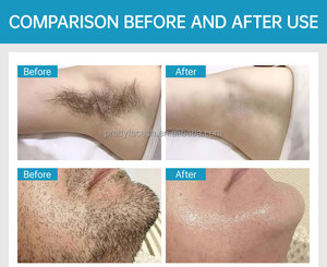 Máy <span class=keywords><strong>laser</strong></span> <span class=keywords><strong>diode</strong></span> cầm tay công suất cao 2000W mới năm 2025, sử dụng <span class=keywords><strong>diode</strong></span> Đức, 3 bước sóng <span class=keywords><strong>laser</strong></span>, thiết bị làm đẹp, triệt lông bằng <span class=keywords><strong>laser</strong></span> tại salon - Product Image 3