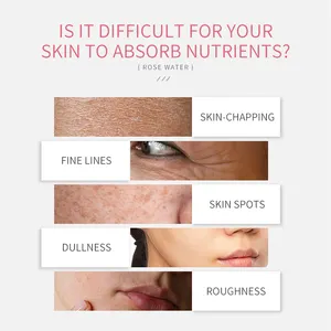 Spray hidratante para cuidados com a pele, água de rosas orgânica natural, marca própria, água de rosas para rosto, toner facial