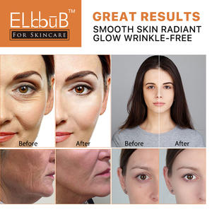 Suero de Vitamina C ELbbuB de Marca Privada OEM de 30 ml, Suero Facial Coreano de Vitamina C Antioxidante Natural de Día y de Noche Antienvejecimiento - Product Image 4