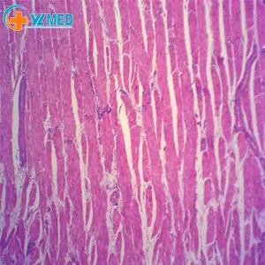Medische Wetenschap Hoge Kwaliteit En Beste Prijs Professionele Anatomie Slides Menselijk Hartspier Microscoop Glijbaan Met Hoge Kwaliteit
