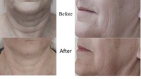 Appareil de lifting facial BIO galvanique anti-points noirs et anti-rides Au-8403-V4 2022 avec gants micro-courants et dispositif de tonification faciale micro-courant
