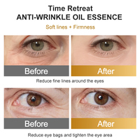 Huile pour les yeux et le visage en marque privée avec rouleau de massage, huile essentielle et rétinol pour les rides, les poches et les cernes sous les yeux