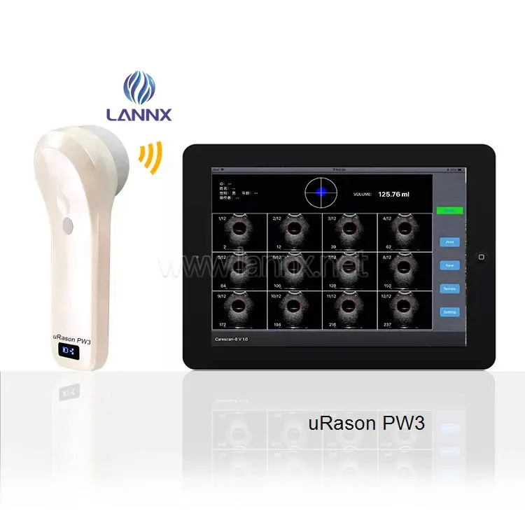 LANNX uRason PW3, envío rápido, escáner de vejiga portátil, sonda de matriz, escaneo de alta velocidad, sonda inalámbrica 4D, ultrasonido de vejiga