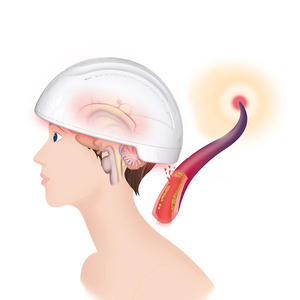 Suyzeko0-20000Hz調整可能な赤色光療法ヘルメットスマートコントロールAlzhimer'sParkinson治療赤外線ヘルメット - Product Image 1