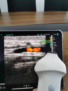 <span class=keywords><strong>Clarius</strong></span> L20 Doppler Portable Wifi Ultraschall Drahtlose Sonde/Handy Ultraschall SonoStar - Product Image 2