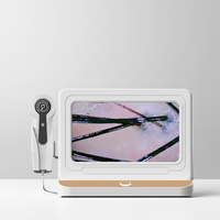 Escáner Digital HD Profesional para el Cuero Cabelludo, Detector de Folículos Pilosos, Analizador de Cabello, Prueba de Crecimiento Capilar, Analizador de Piel, Máquina de Belleza