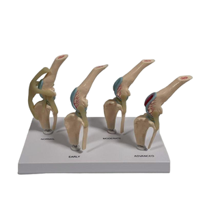 Modelo Comparativo de Articulación de <span class=keywords><strong>Rodilla</strong></span> Canina de Cuatro Etapas, Modelo de Demostración de Lesiones Articulares Normales, Tempranas, Moderadas y Avanzadas - Product Image 4