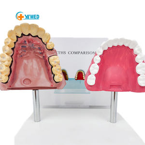 <span class=keywords><strong>Model</strong></span> pengajaran sains medis kedokteran gigi, sumber daya kesehatan manusia Oral dan merokok <span class=keywords><strong>Model</strong></span> Perbandingan mulut - Product Image 5