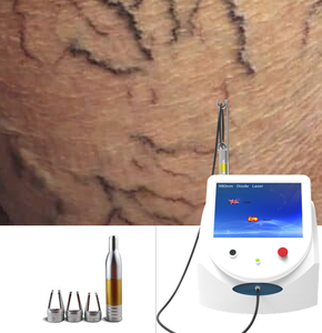 Máquina <span class=keywords><strong>Láser</strong></span> <span class=keywords><strong>Vascular</strong></span> de Diodo de 980 Nm para Eliminación de Arañas Vasculares, Diseño 2026, para Salón y Clínica - Product Image 1