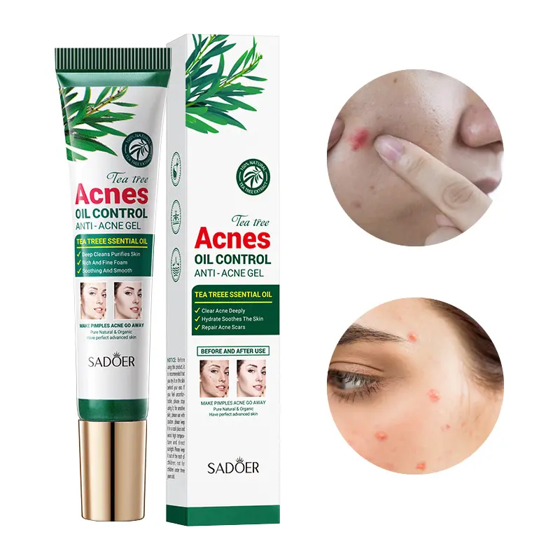 Groothandel Olie Controle Krimpen Poriën Theeplant Vervaagt Acne Markeringen Effectief Verwijdert Acne Verminderen Anti Acne Gezichtscrème