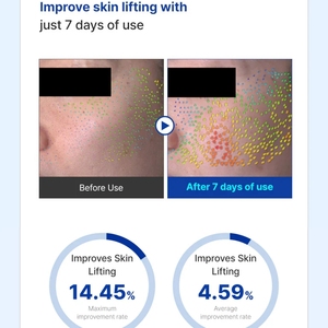 ETRUN ALISA marca privada PDRN crema <span class=keywords><strong>de</strong></span> barrera ultra hidratante aclara las manchas oscuras cura las cicatrices calmar la piel sensible y grasa - Product Image 3