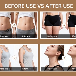 Dispositivo de Belleza Portátil Recargable por USB C con Vacío de Presión Negativa, Masajeador Corporal, Anticelulitis, Reductor de Grasa - Product Image 5