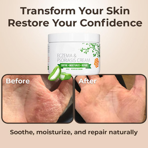 Crème au miel de Manuka pour le corps, biologique, naturelle, végétalienne, nourrissante, hydratante, réparatrice, pour l'eczéma et les éruptions cutanées, tous types de peau - Product Image 4