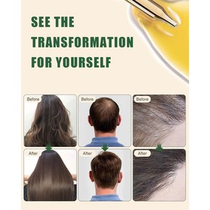 Suero para el Crecimiento del Cabello de Marca Privada 100% Aceite Puro, Desintoxica el Cuero Cabelludo, Repara la Rotura del Cabello, Fortalece las Raíces del Cabello para Todo Tipo de Cabello - Product Image 5