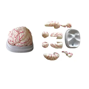 Model anatomi otak manusia medis, corong yang dapat dilepas, model sistem saraf inter-entrikular