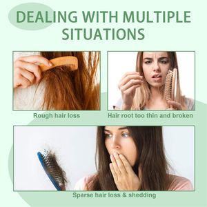 Crema de Aceite de Batana Wiyun 100g, Fortalece las Raíces del Cabello, Anticaída, Reparadora, Hidratante y Suavizante - Product Image 5