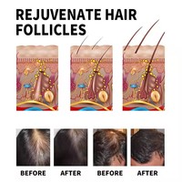Organics Romarin Menthe Croissance des Cheveux Huile Beurre Masque Revitalisant Fortifiant Pommade Huile Cuir Chevelu Nourrit 4 Onces