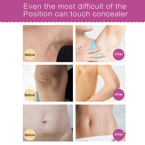 ครีมทาใต้วงแขน ขาหนีบ และจุดซ่อนเร้น ALIVER Private Label ช่วยให้ผิวขาวกระจ่างใส ไม่มีผลข้างเคียง - Product Image 3