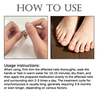 Traitement antifongique des ongles à l'huile d'arbre à thé et à l'aloe vera, solution réparatrice pour les ongles des pieds et des mains, restaure la santé des ongles