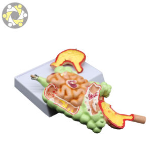 العلوم الطبية التشريحية نموذج الأمعاء المعوية المرضية والمعدة - Product Image 6