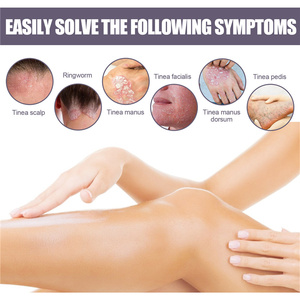 Eelhoe Spray de 30 ml para <span class=keywords><strong>Eczema</strong></span> y Psoriasis, Inflamación de la Piel, Enrojecimiento, Picazón, Tratamiento Líquido para Psoriasis, <span class=keywords><strong>Eczema</strong></span> y Dermatitis - Product Image 3