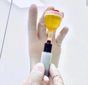 PET-Material Y-Typ PRP-Röhrchen mit überlegener Klarheit | Entwickelt für präzise ortho pä dische und Haar wiederherstellung anwendungen - Product Image 5