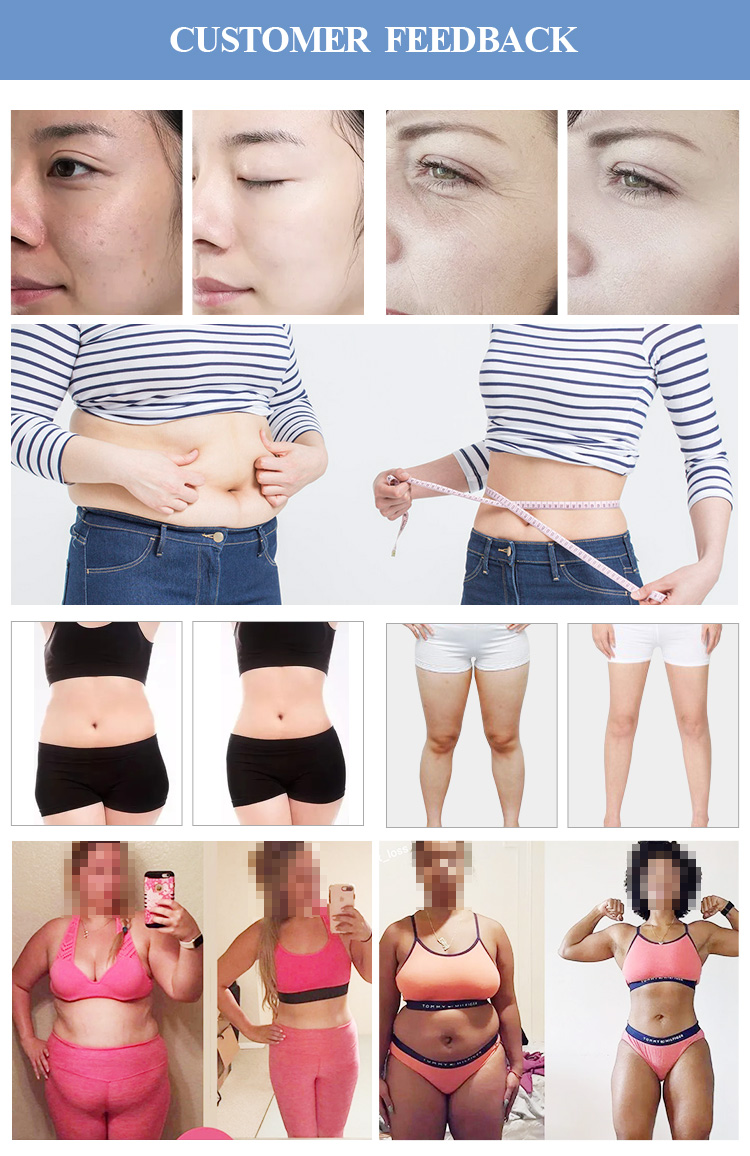 Bieir vela vacuum roller RF cavitation fat burning slimming machine beauty salon SPA equipment