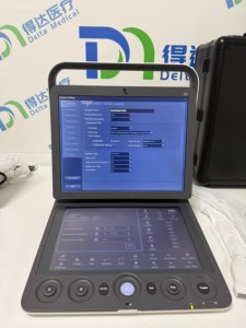 เครื่องอัลตราซาวนด์ Sonoscape S9 S9V S8 S8exp แบบพกพา พร้อมระบบ Color Doppler และหน้าจอสัมผัสขนาด 13.3 นิ้ว สำหรับใช้ในสัตว์และมนุษย์ - Product Image 1