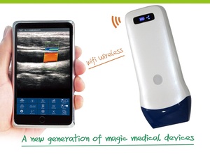 2025 Jenis <span class=keywords><strong>Probe</strong></span> <span class=keywords><strong>Ultrasound</strong></span> 7.5 10MHz <span class=keywords><strong>Probe</strong></span> Linear Genggam <span class=keywords><strong>Ultrasound</strong></span> Nirkabel Pemindai <span class=keywords><strong>Ultrasound</strong></span> Portabel - Product Image 2