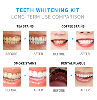 Kit de gel blanqueador de dientes con luz LED Kits de brillo de dientes de peróxido dental Juego de bolígrafo blanqueador de dientes