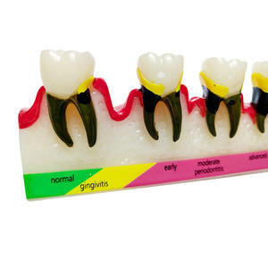 Nuevo Modelo Dental de Alta Calidad, Modelo de Clasificación Periodontal B, Modelo de Enseñanza Dental - Product Image 2