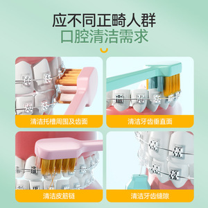 Cepillo de Dientes Ortodóntico Jacquard, Cepillo de Dientes en Forma de U para Aparatos Ortodónticos, Adecuado para Limpiar Entre los Dientes, Cepillo de Dientes 2 en 1 con Cerdas Suaves - Product Image 2