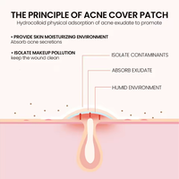 Patchs Hydrocolloïdes Personnalisés pour l'Acné, 12 Unités, Motif Points et Étoiles Colorés et Adorables, Faciles à Retirer, pour le Visage, Soins de la Peau Végétaliens, Produits de Beauté OEM/ODM