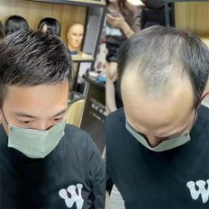 Toppa capelli da uomo personalizzata H725 fiber per la costruzione di capelli neri per la perdita di capelli dei genitori - Product Image 1