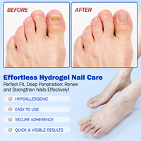 ELAIMEI Patchs de réparation des ongles Fungal Nall Repair Repaire sans effort Hydrogel Nail Care Patches pour ongles fongiques