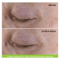 Crème pour les yeux au rétinol MOOYAM, réduit les rides et les ridules, crème pour les yeux au rétinol intense pour les cernes et les poches