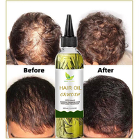 Sérum Huile de Croissance Rapide des Cheveux à Base de Plantes Naturelles 100% Biologique Romarin Nourrissant le Cuir Chevelu Huile de Croissance des Cheveux Sérum de Repousse des Cheveux