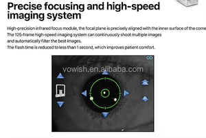 Microscopio especular corneal <span class=keywords><strong>de</strong></span> Oftalmología Microscopio especular corneal médico SW-7000 - Product Image 3