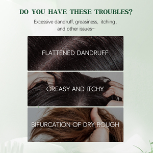 Champú Greenlem Refrescante con Aceite de Árbol de Té para Cabello Graso, Limpieza Profunda del Cuero Cabelludo, Reduce la <span class=keywords><strong>Caspa</strong></span> y las Raíces Escamosas y con Picazón - Product Image 3