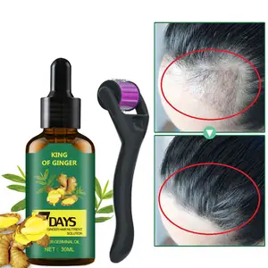 Grosir Perawatan Anti Rambut Rontok Memperbaiki Minyak Esensial Jahe Wanita Biotin Minyak Pertumbuhan Rambut Minyak Serum Pertumbuhan Kembali Rambut untuk Pria