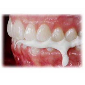 Registrazione del morso di Chemoment-prodotti della clinica dentale - Product Image 6