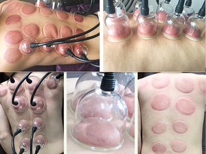 Macchina Portatile per l'Ingrandimento del <span class=keywords><strong>Seno</strong></span> e dei Glutei con Pompa Grande per Uso Domestico - Product Image 5