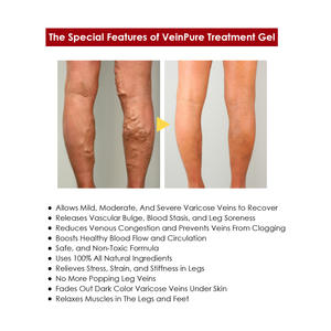 Crème Gel Herbale Apaisante pour Phlébite, Angéite et Varices, Traitement Gel pour Varicosités - Product Image 4