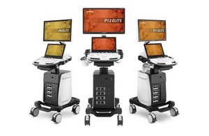 Sistema de Diagnóstico por Ultrasonido Doppler Digital de Alta Calidad Sonoscape P12 Elite con Imagen I+Scan para Humanos/Hospitales/Clínicas - Product Image 2