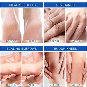 Adoucir et hydrater la peau crème de massage à l'huile de lavande et à l'urée pour les talons crevassés mains sèches desquamation des sourcils et des genoux rugueux - Product Image 5