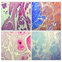 individual popular pathological educational human pathology microscope prepared slides
