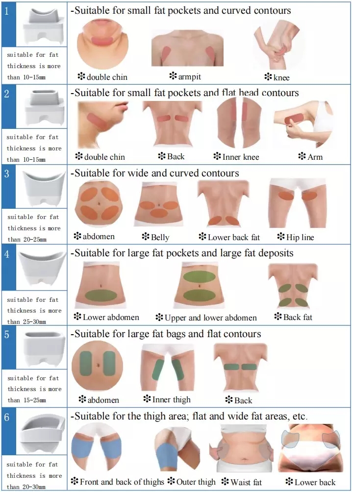 multi-size cryolipolysis handle treatment areas