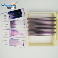 Hematology Prepared Slides Blood Smear Microscope Slide Handmade From Glass