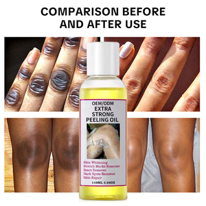 OEM/ODMプライベートラベル イエローピーリングオイル エクストラストロングフォーミュラ 傷跡除去 ストレッチマーク 美白 - Product Image 2