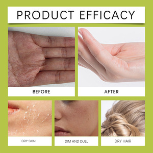 Gel puro de Aloe Vera 100%, etiqueta privada orgánica, venta al por mayor, Exfoliante para aclarar la piel para lavado de cara, quemaduras solares, calmante - Product Image 2